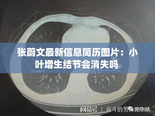 张蔚文最新信息简历图片：小叶增生结节会消失吗 