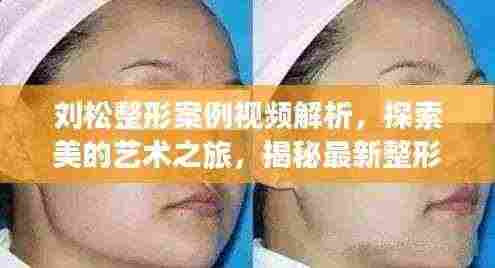 刘松整形案例视频解析，探索美的艺术之旅，揭秘最新整形趋势