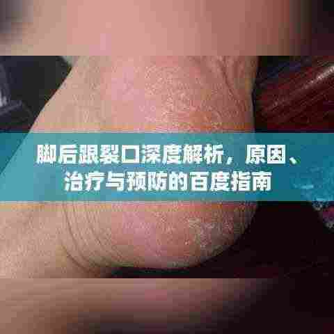脚后跟裂口深度解析，原因、治疗与预防的百度指南